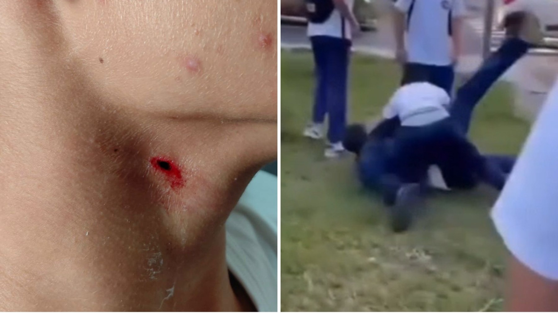 Violência Escolar em Ponta Grossa: A Análise Profunda da Tentativa de Homicídio e Seus Ecos na Comunidade