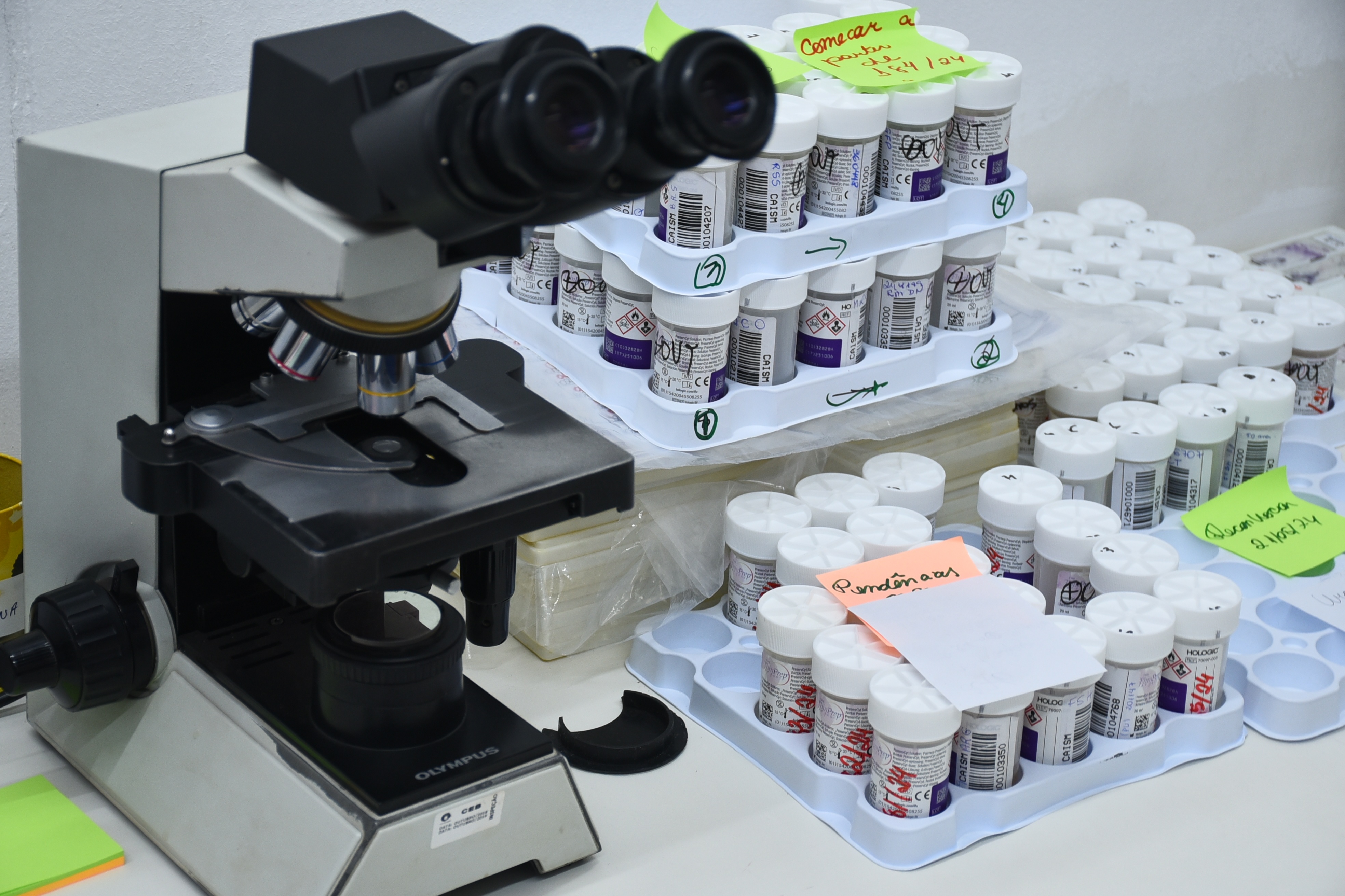 Belém Lidera Transição no Rastreamento do Câncer de Colo do Útero com DNA-HPV no SUS