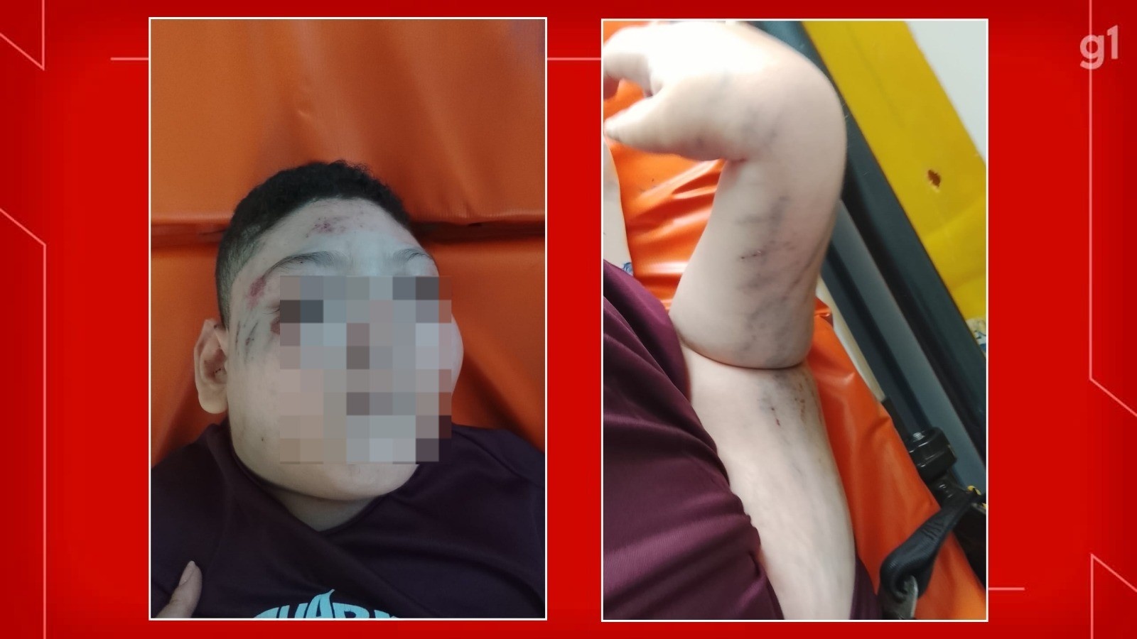 Acessibilidade Interrompida: Acidente no Metrô do DF Expõe Falhas Estruturais e o Alto Preço da Exclusão