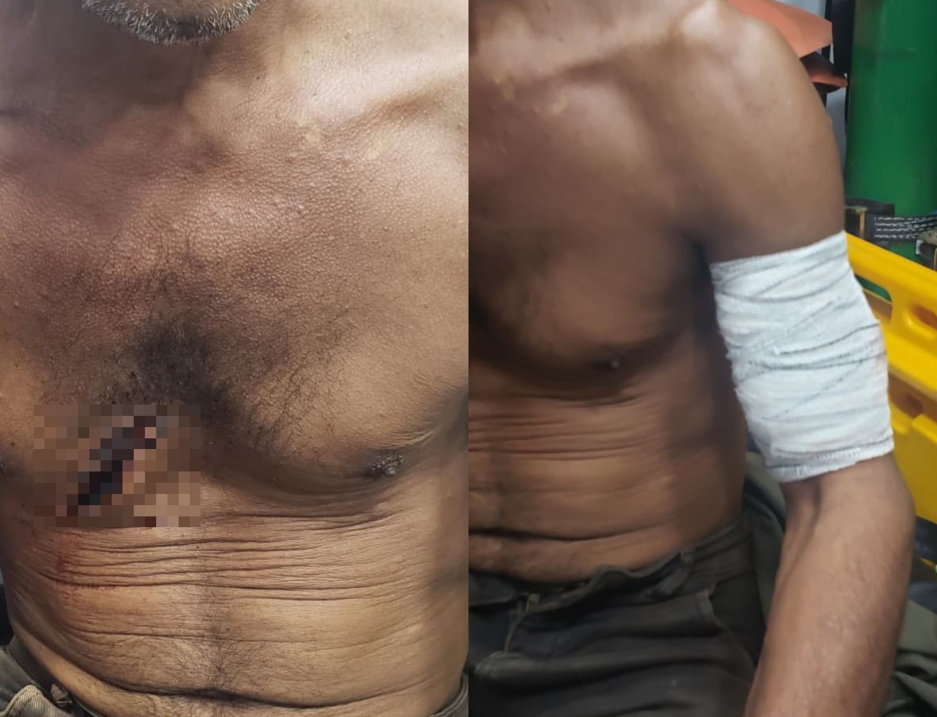 A Violência Silenciosa do Campo: O Ataque em Alto Alegre e a Fragilidade da Segurança Rural em Roraima