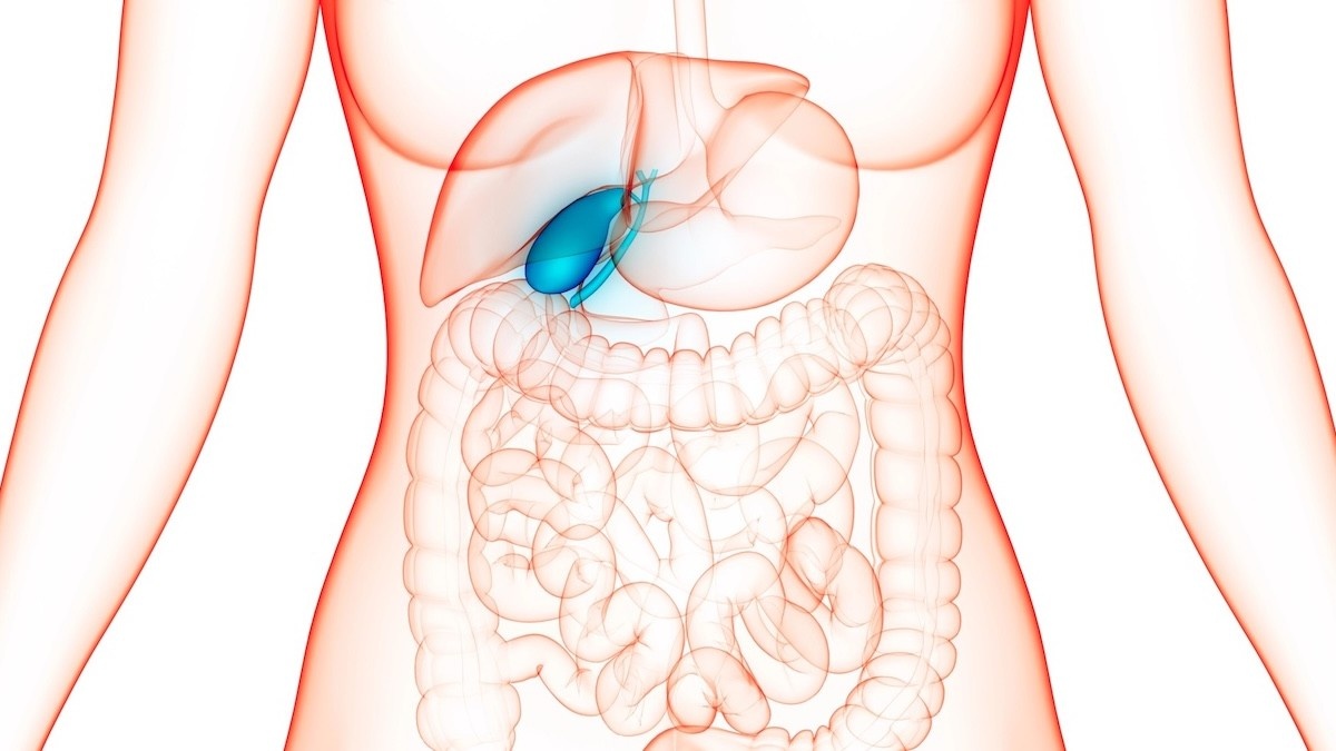 Colecistectomia: A Urgência Silenciosa por Trás da Cirurgia de Vesícula Biliar