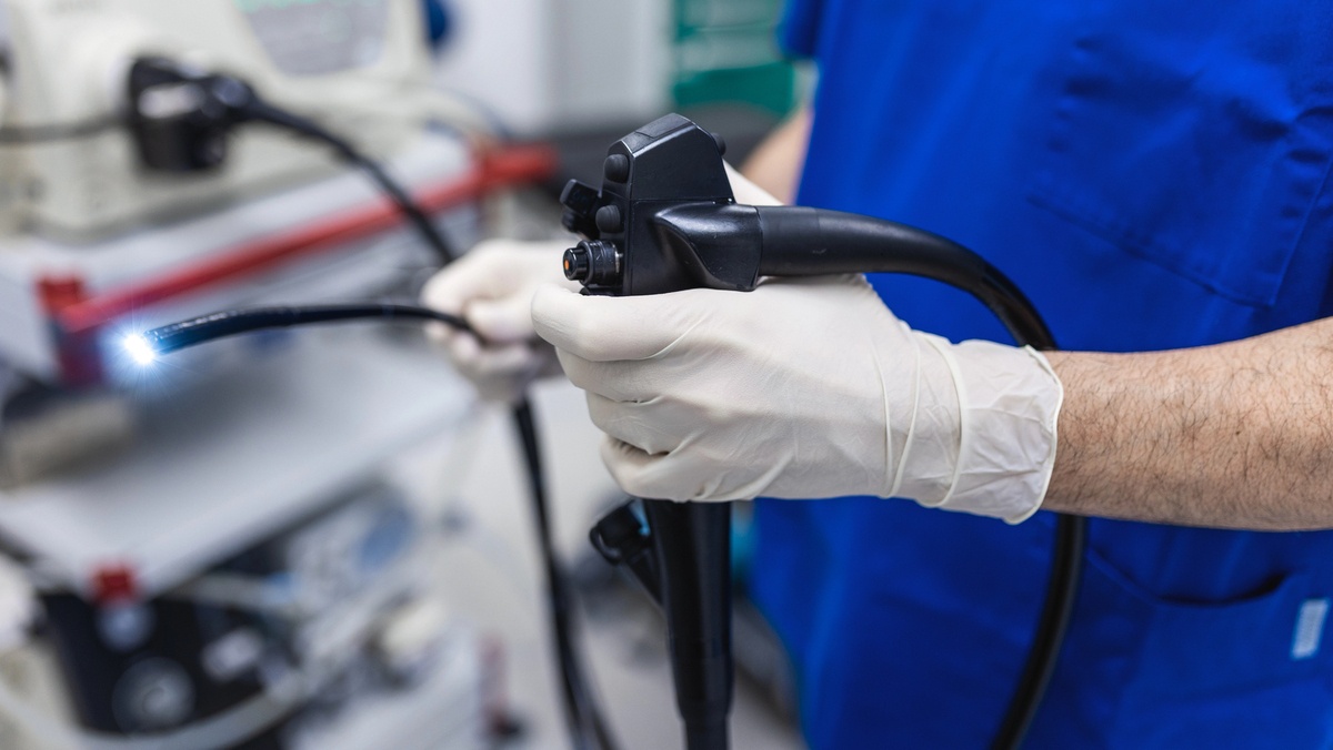 Câncer Colorretal em Ascensão: O Dilema da Colonoscopia e o Futuro da Saúde Preventiva no Brasil