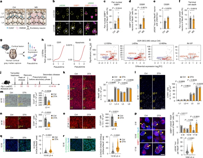 Desvendado Mecanismo Chave da Degeneração Neuronal na Esclerose Múltipla