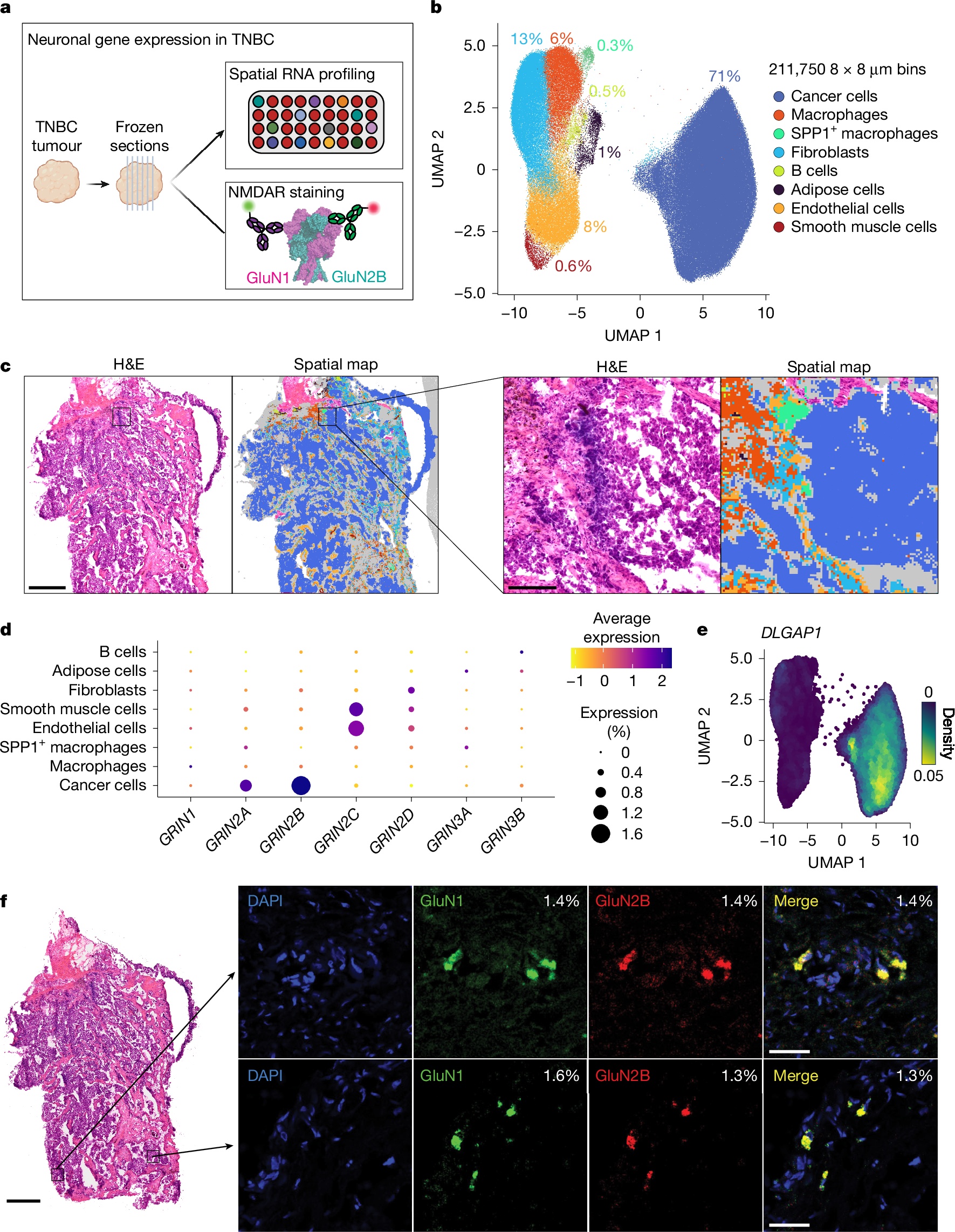 Descoberta Mecanismo Autoimune no Câncer de Mama Triplo-Negativo Liga Imunidade Antitumoral à Neurotoxicidade