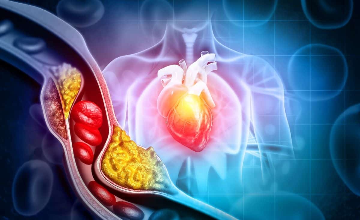 A Vanguarda da Edição Genética: Infusão Única Reduz Colesterol e Redefine o Tratamento Cardiovascular