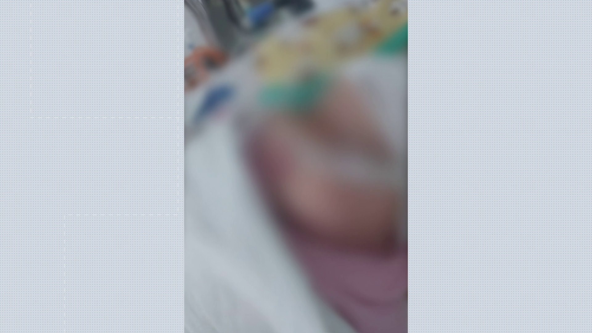 Falha em Procedimento Crítico: Objeto no Pulmão de Bebê Exacerba Desafios da Saúde em Sergipe