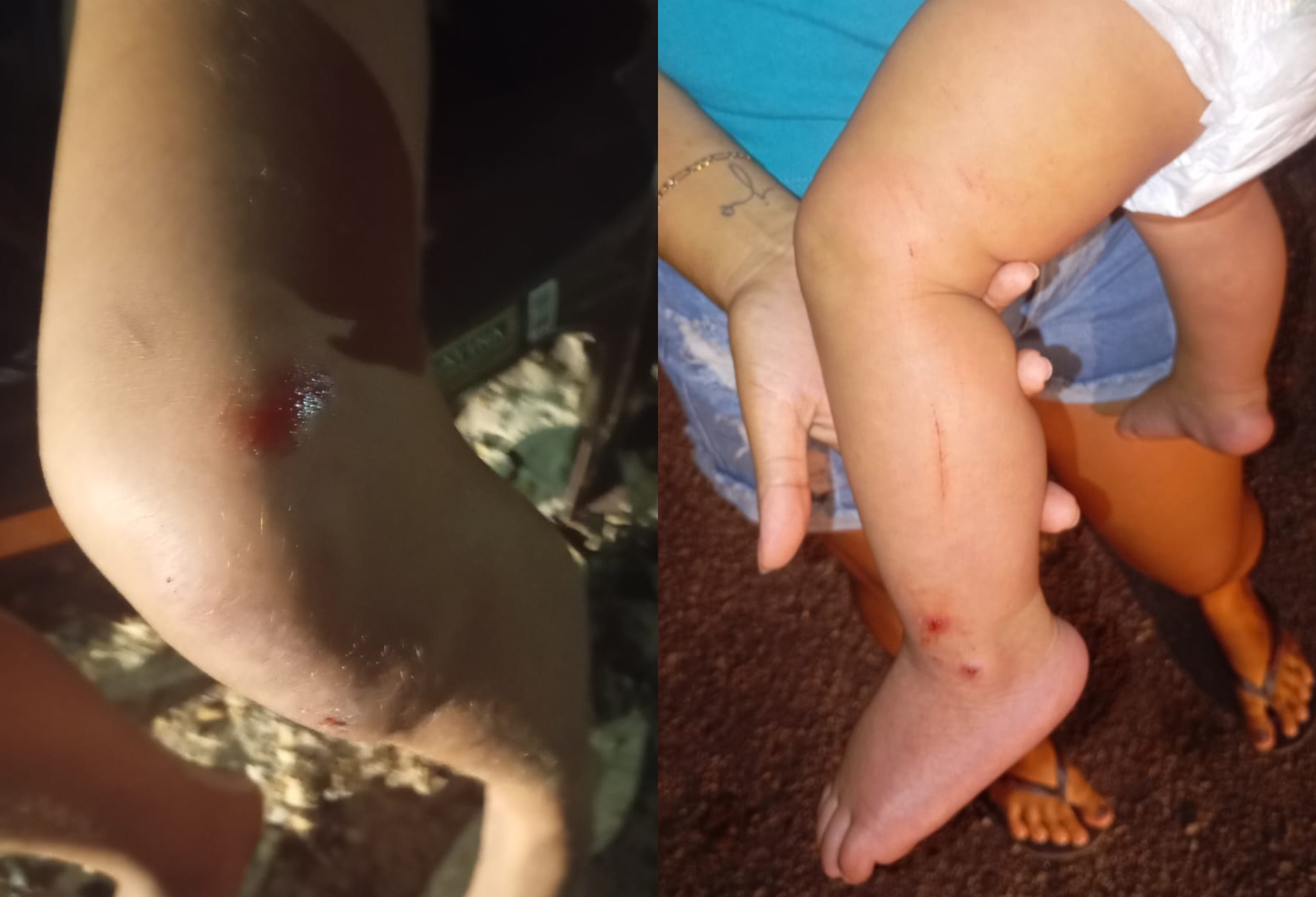 Violência Doméstica em Roraima: O Alerta Silencioso de São Luiz e a Urgência da Proteção