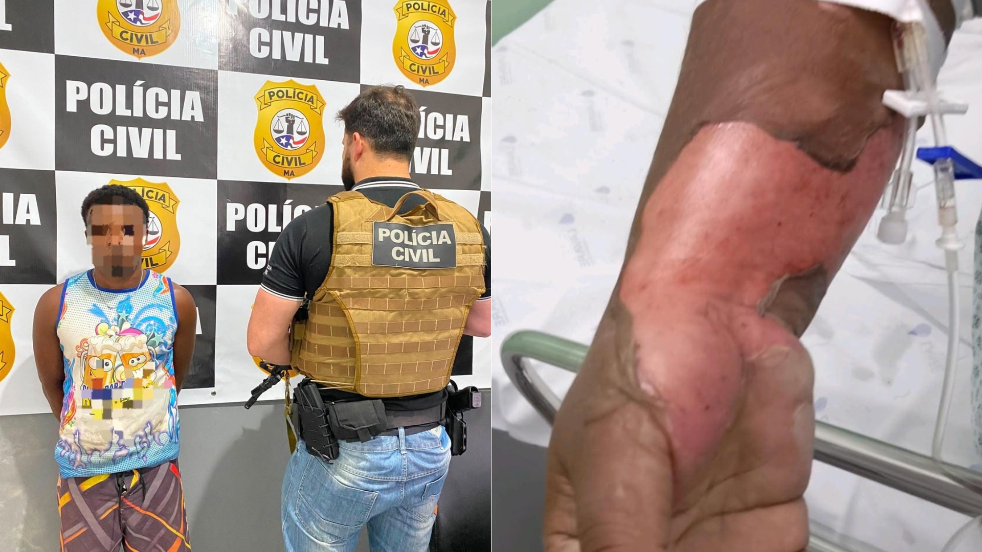 Prisão por Tentativa de Feminicídio em Rosário: Um Alerta Regional e o Desafio da Proteção à Mulher
