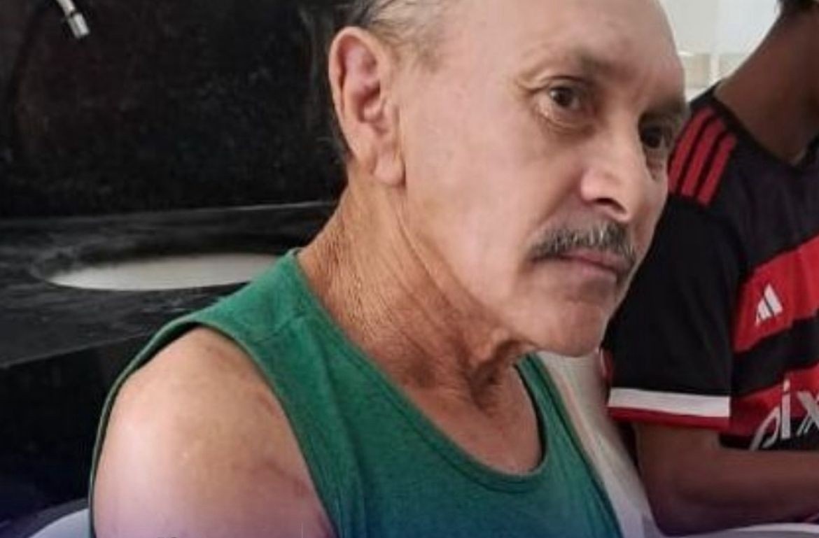 Atropelamento Fatal em Lagoa Seca: O Custo Humano da Falta de Segurança Viária e Impunidade no Agreste Paraibano