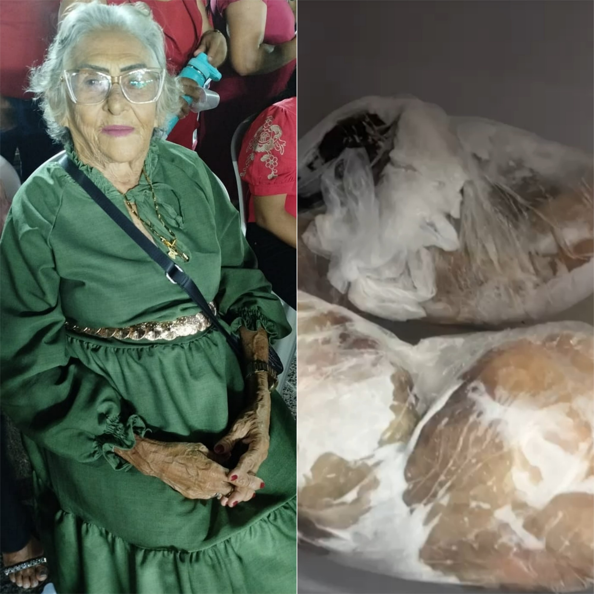 Tragédia da Ciguatera em Natal: Morte de Idosa Expõe Desafios Críticos na Segurança Alimentar do RN