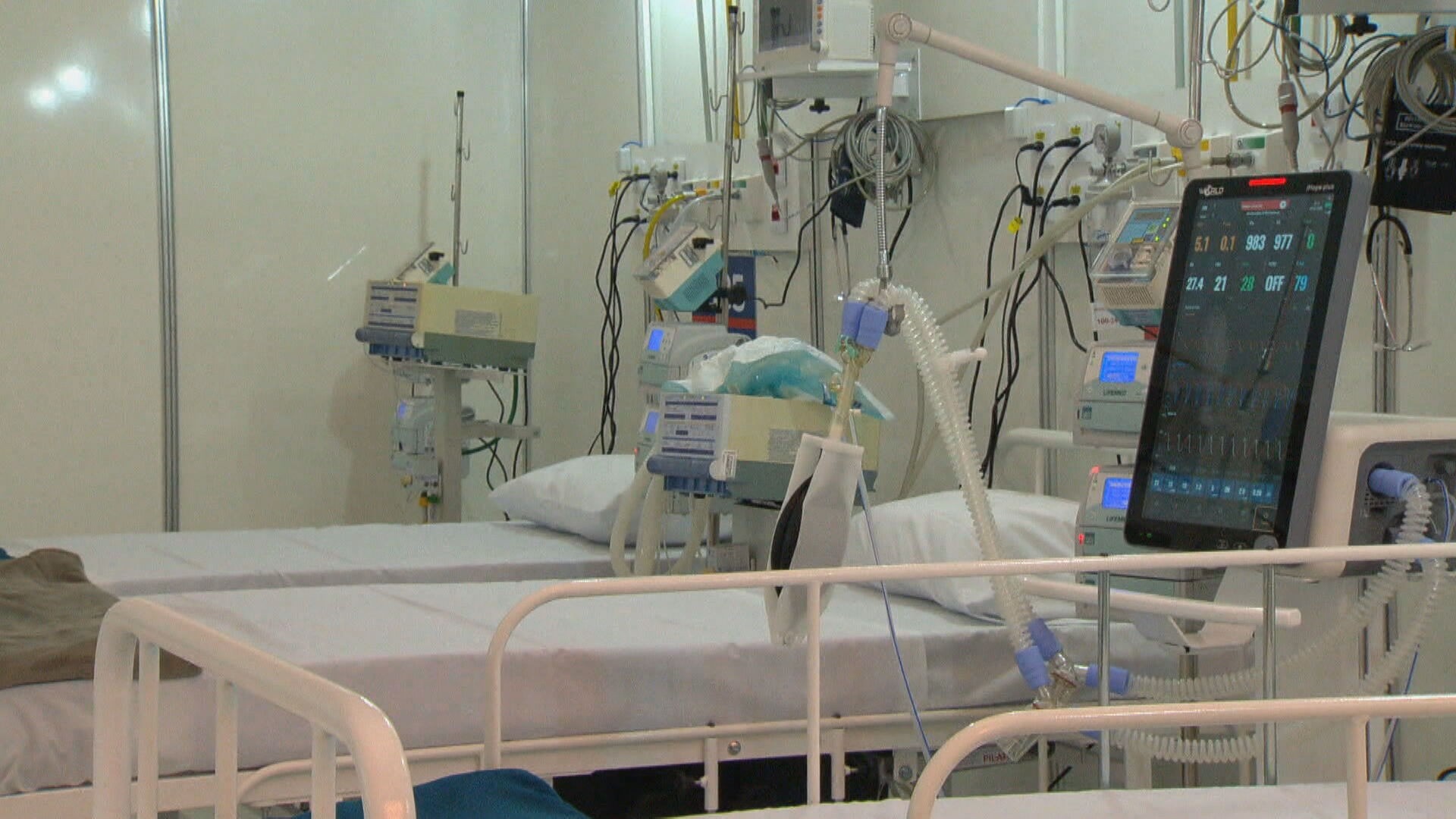 Justiça Condena Rondônia: R$ 1,7 Milhão do SUS Desviado Expõe Crise Crônica na Gestão da Saúde Estadual