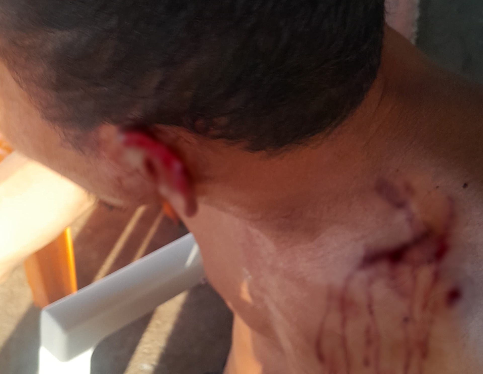 Boa Vista: Incidente em Bar Expõe Fragilidades nas Relações e o Alcance da Justiça