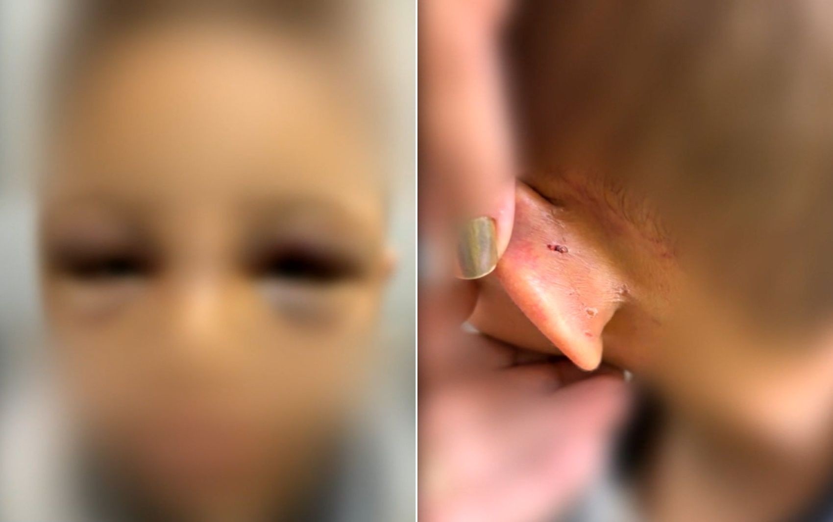 Violência Contra a Criança em Goiás: O Alerta Regional que Exige Mais Que Punição