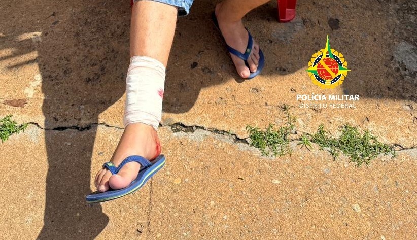 Segurança Urbana no DF: Ataque de Pitbull no Paranoá Reacende Debate sobre Posse Responsável