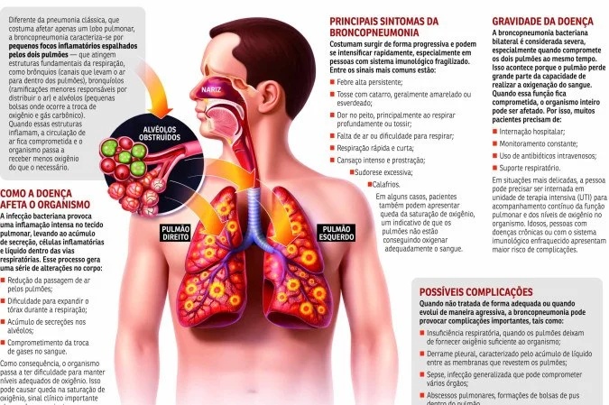Saúde de Bolsonaro: Análise das Implicações Político-Institucionais