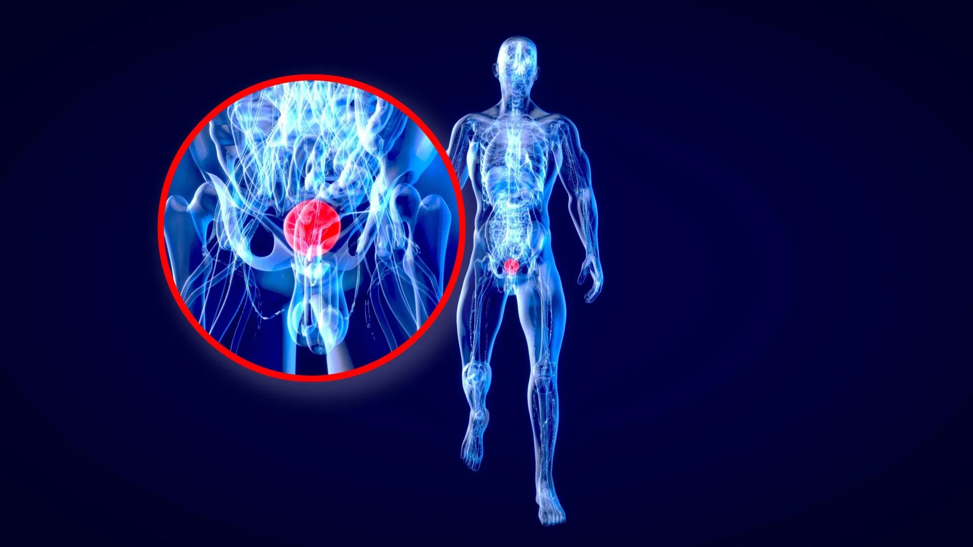 Daltonismo Eleva Risco de Mortalidade por Câncer de Bexiga em 52%, Alerta Estudo de Stanford
