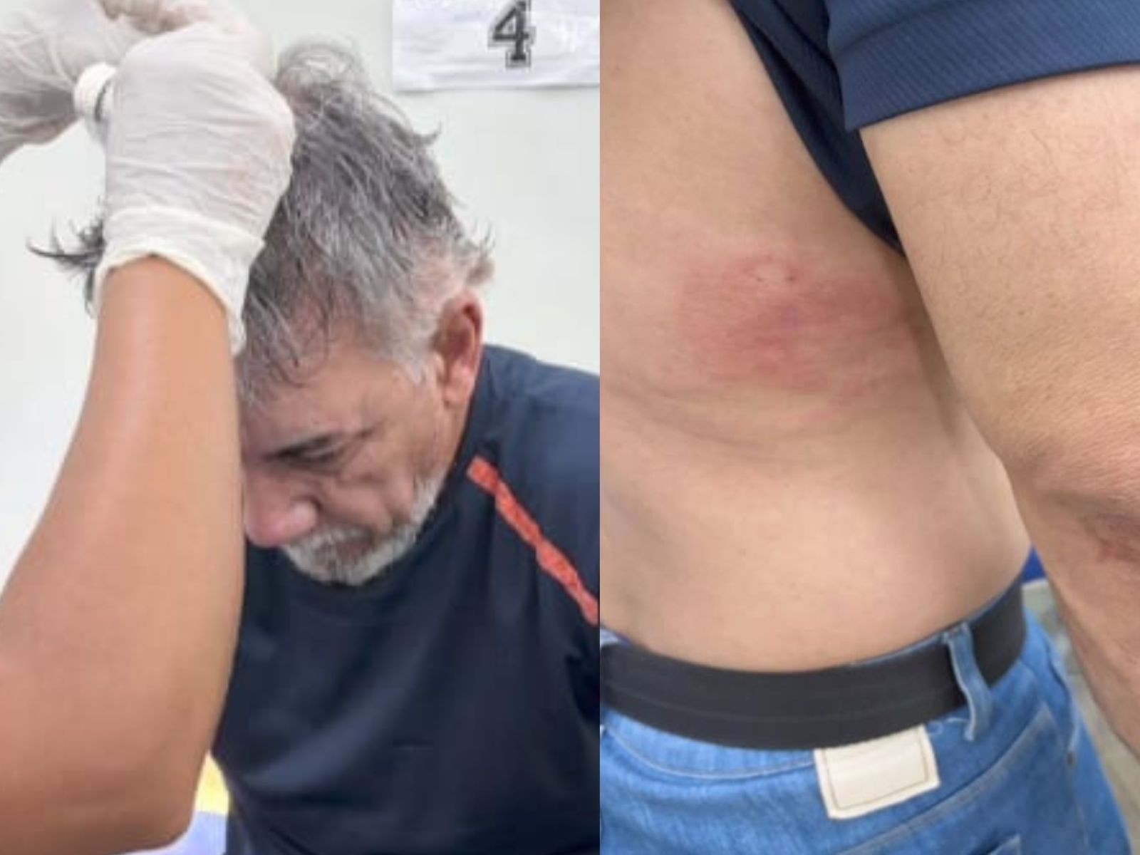 Agressão a Jornalista no Acre Revela Fratura Profunda na Salvaguarda da Informação Regional